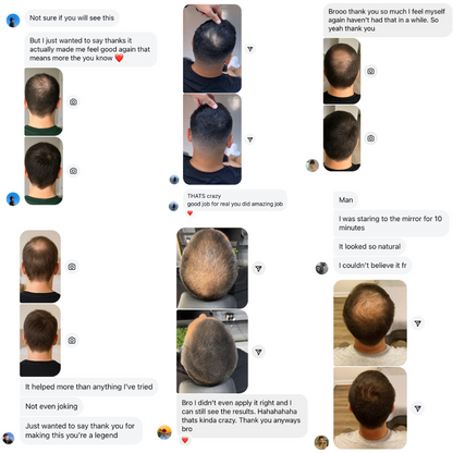 Final 3 Hours: 60%OFF🔥 Hairline Powder - Root Touch Up & Hair Loss Cover Up